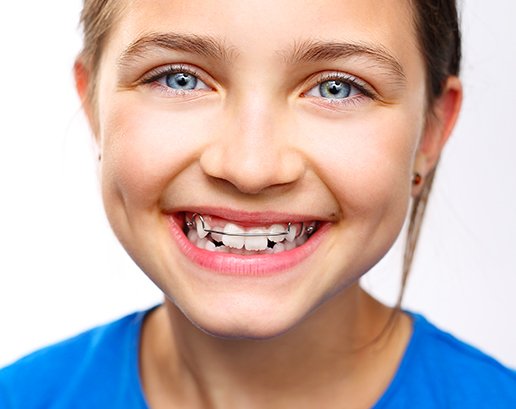 Appareil dentaire fixe